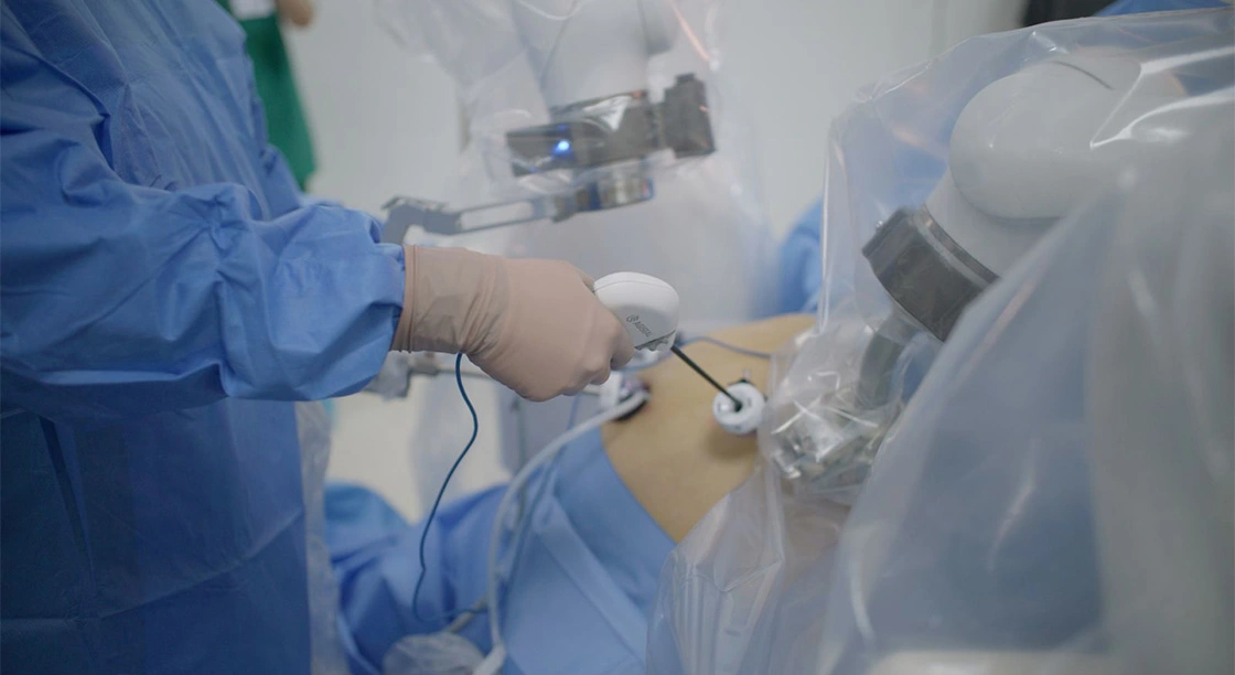 Cirugía Bariátrica